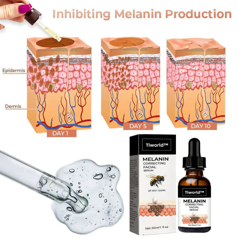 ✨Fast Dark Spot Remover-Tiworld™ Melanin Correcting Facial Serum