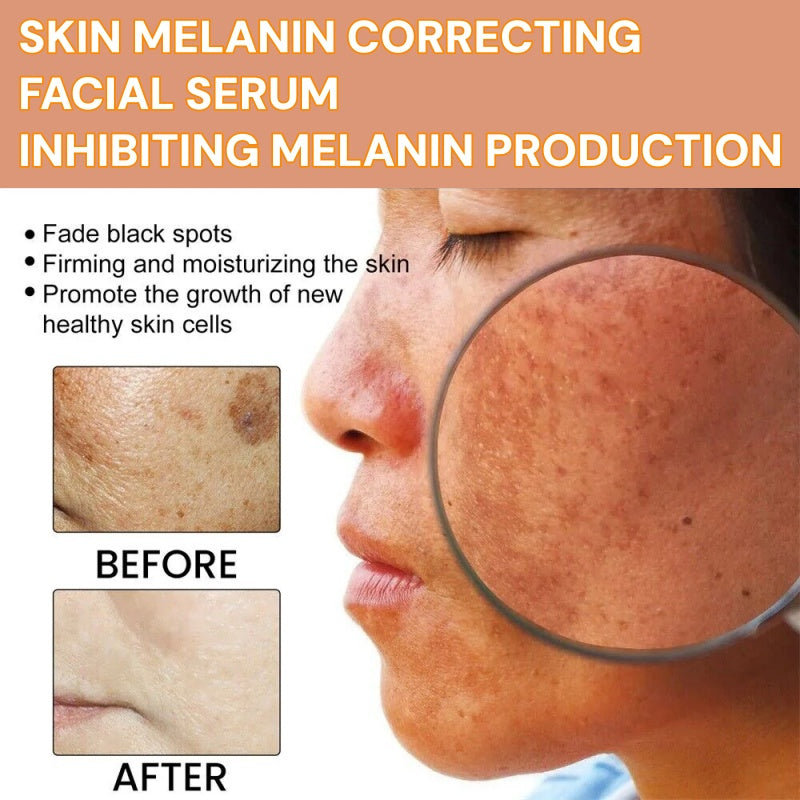 ✨Fast Dark Spot Remover-Tiworld™ Melanin Correcting Facial Serum