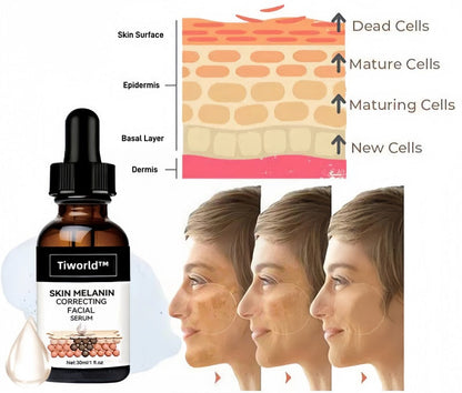 ✨Fast Dark Spot Remover-Tiworld™ Melanin Correcting Facial Serum