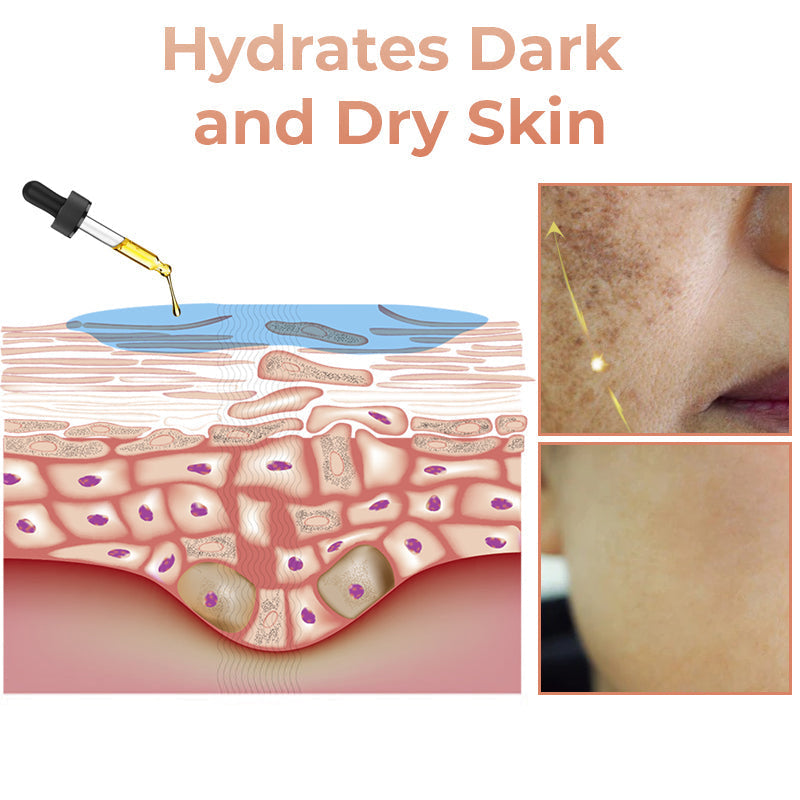 ✨Fast Dark Spot Remover-Tiworld™ Melanin Correcting Facial Serum