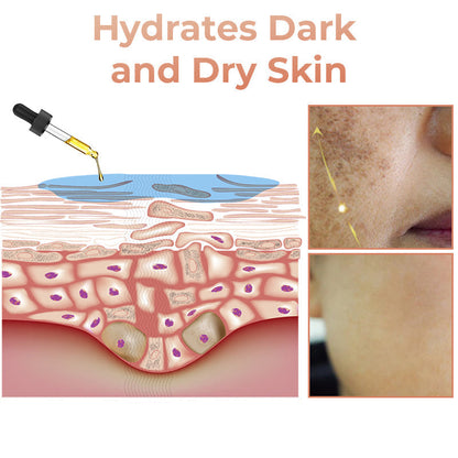 ✨Fast Dark Spot Remover-Tiworld™ Melanin Correcting Facial Serum