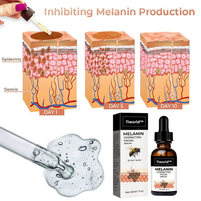 ✨Fast Dark Spot Remover-Tiworld™ Melanin Correcting Facial Serum